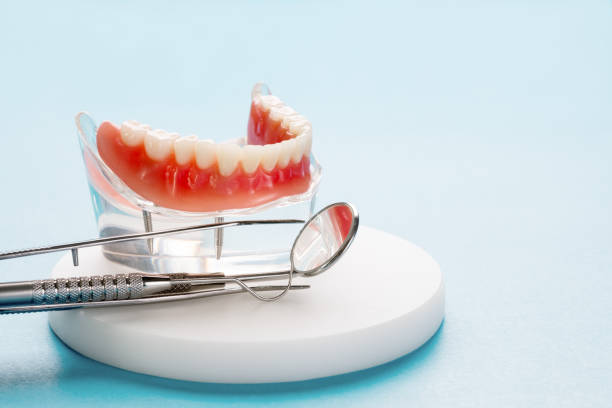Full Mouth Reconstruction in Patrick Af, FL